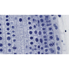 Набір мікропрепаратів Bresser високоякісних 10 шт (5984500) (931509)