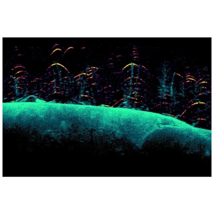 Ехолот Lowrance EAGLE-5 SPLITSHOT HD ROW (000-16112-001)